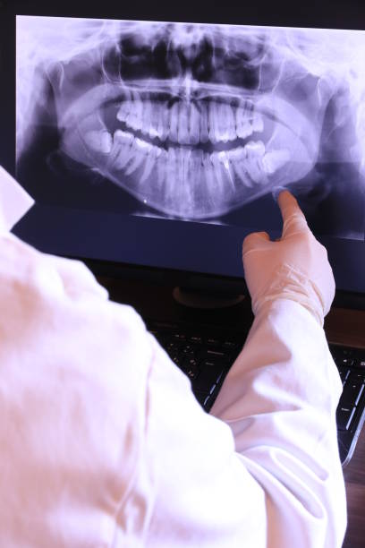 Best Emergency Dentist for Lost Fillings or Crowns in Village Green, NY