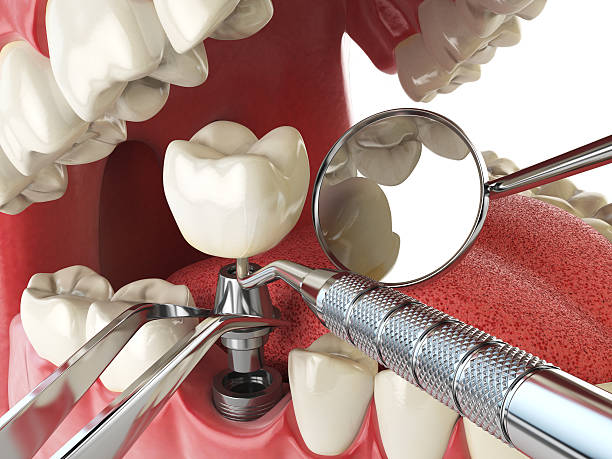 Best Emergency Dentist for Knocked-Out Tooth in Village Green, NY